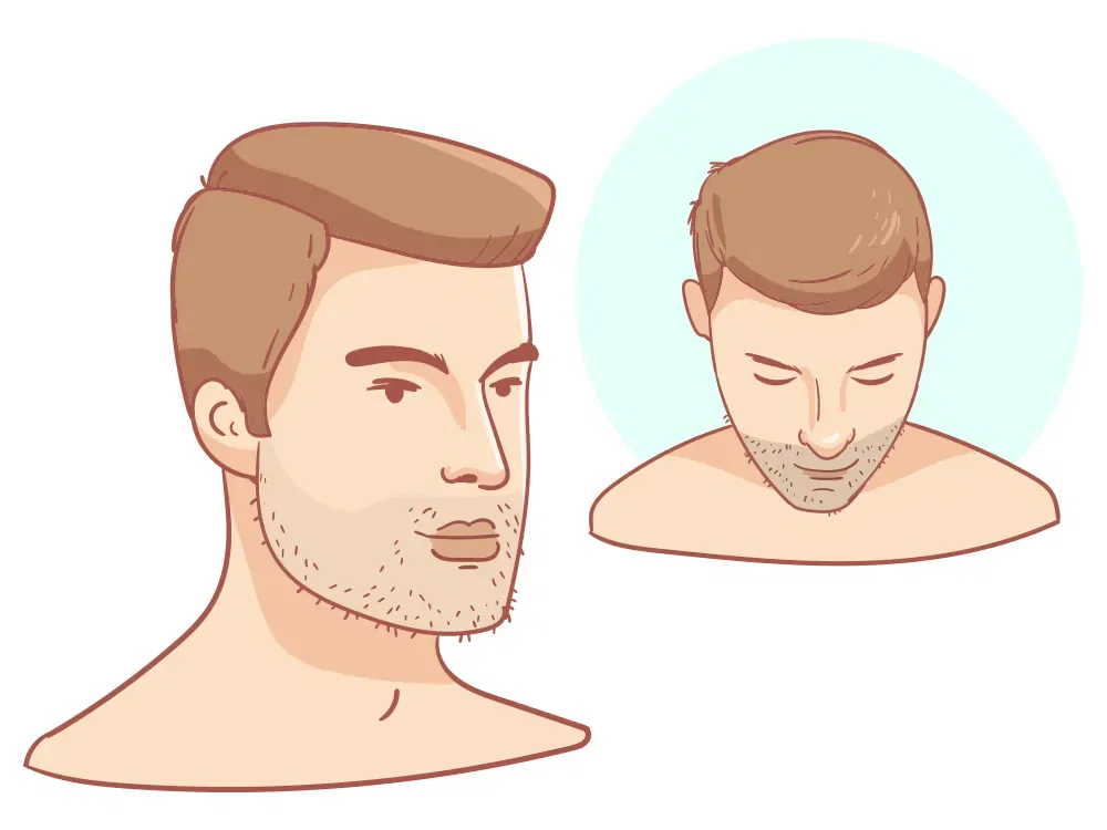 Pas de perte de cheveux