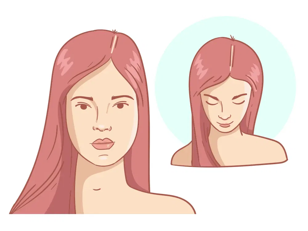 Ligne de cheveux en recul + couronne légère